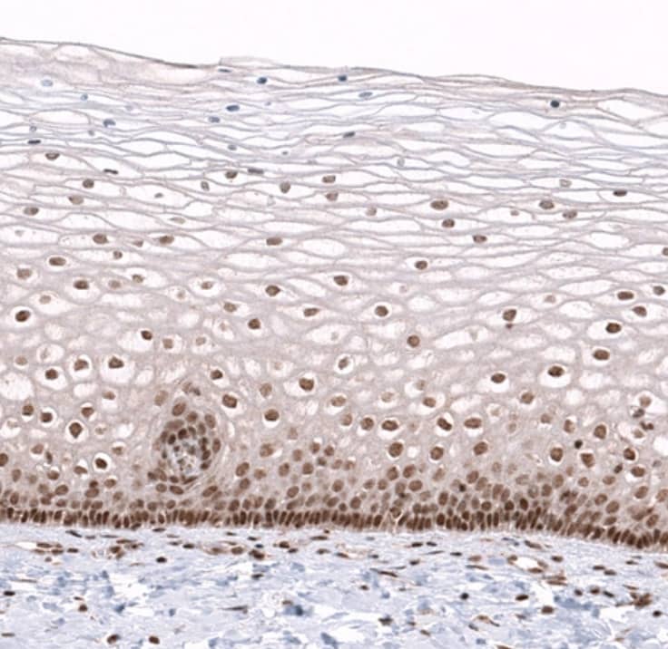 Staining of human cervix shows moderate to strong nuclear positivity in squamous epithelial cells.