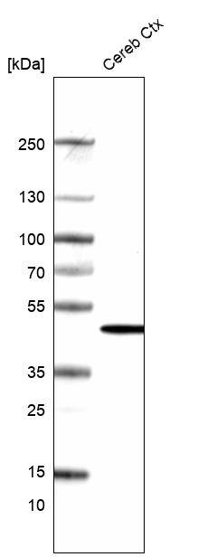 Analysis in human cerebral cortex tissue.