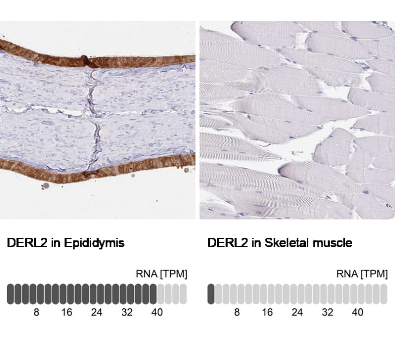 Immunohistochemistry-Paraffin Derlin-2 Antibody - BSA Free