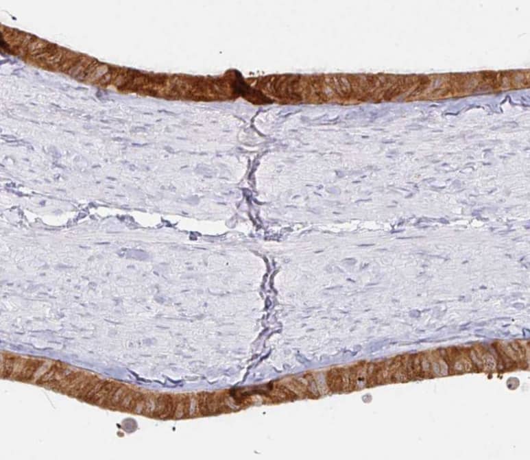 Immunohistochemistry-Paraffin Derlin-2 Antibody - BSA Free