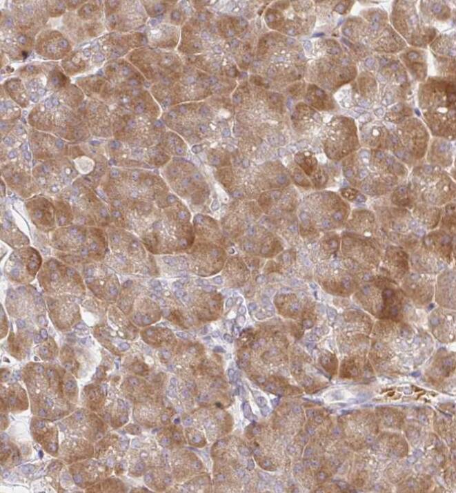 Immunohistochemistry-Paraffin Derlin-2 Antibody - BSA Free