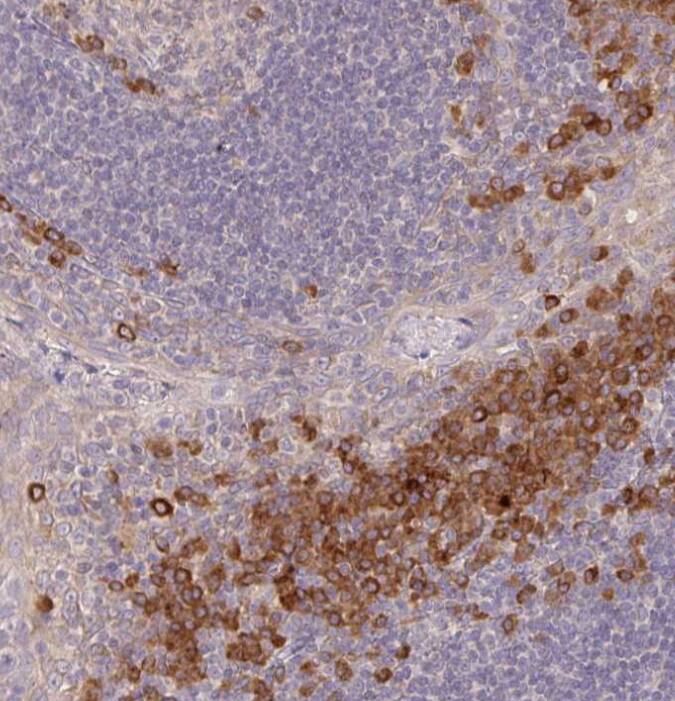 Immunohistochemistry-Paraffin Derlin-2 Antibody - BSA Free