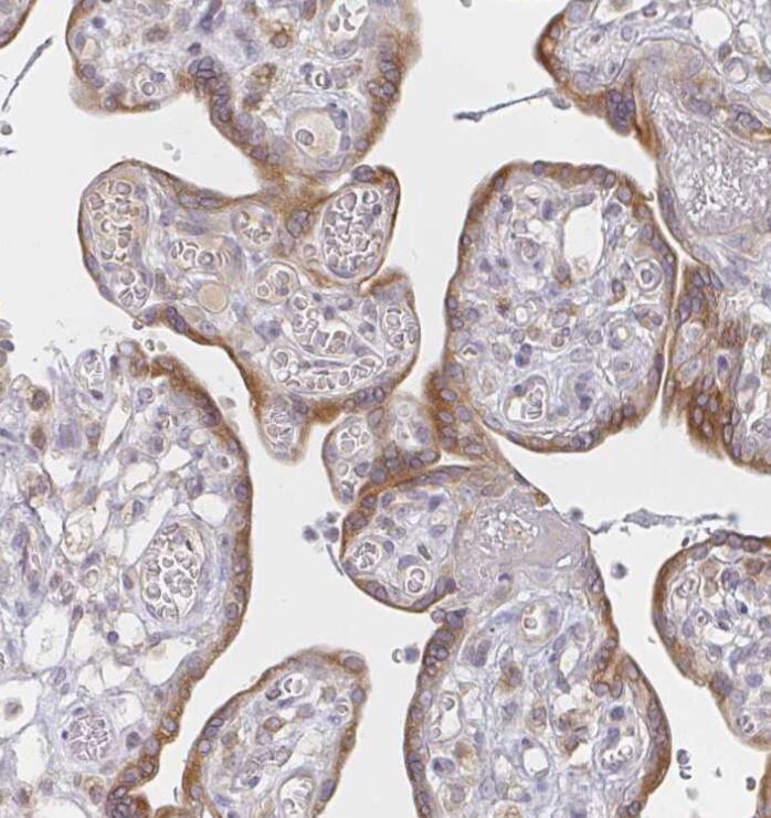 Immunohistochemistry-Paraffin Derlin-2 Antibody - BSA Free