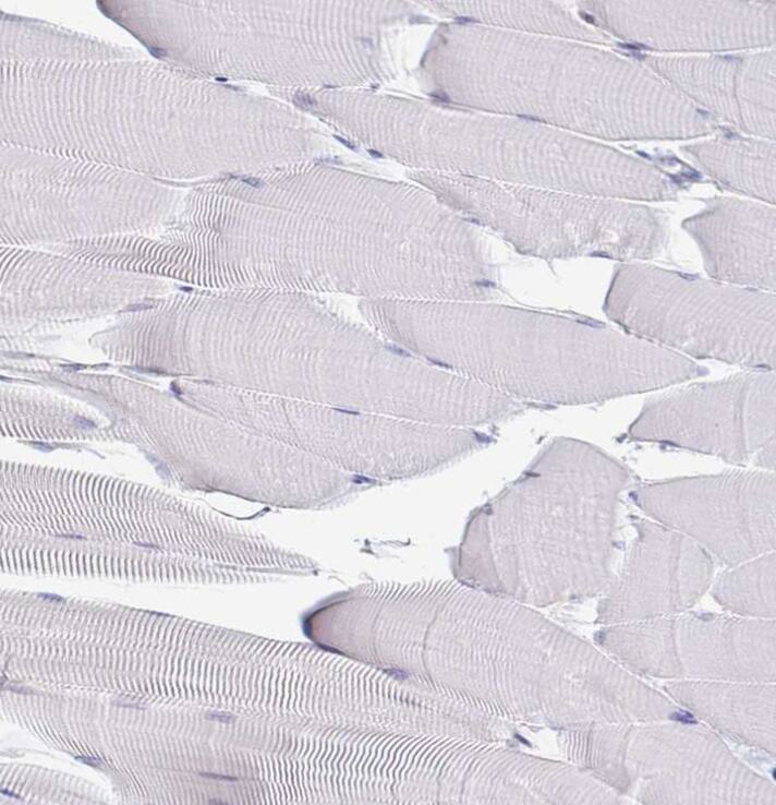 Immunohistochemistry-Paraffin Derlin-2 Antibody - BSA Free