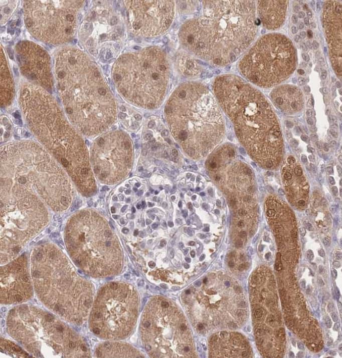 Staining of human kidney shows strong cytoplasmic and nuclear positivity in trophoblastic cells.