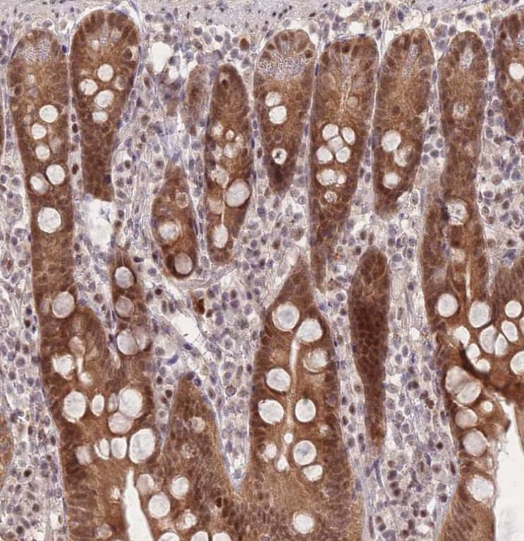 Staining of human small intestine shows strong cytoplasmic and nuclear positivity in glandular cells.