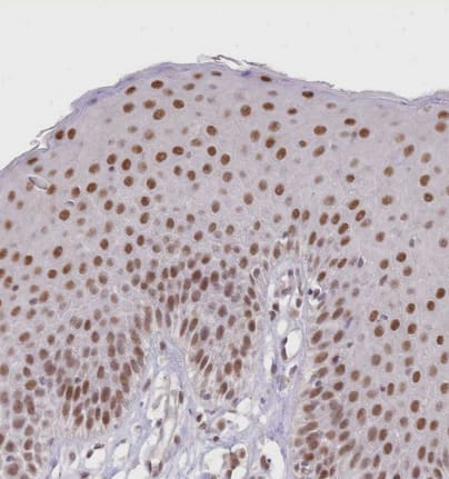 Immunohistochemistry-Paraffin: UBXN7 Antibody [NBP2-47589] - Staining of human skin shows moderate nuclear positivity in squamous epithelial cells.