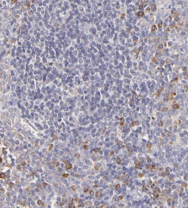 Staining of human tonsil tissues shows moderate cytoplasmic positivity in non-germinal center cells.