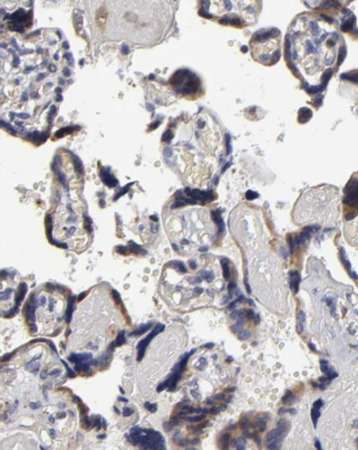 Staining of human placenta shows moderate cytoplasmic positivity in trophoblastic cells.