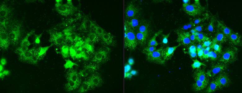 Immunocytochemistry/Immunofluorescence: GCM1 Antibody [NBP2-48520] - Analysis of BeWo human carcinoma cells. GCM1 & Merge with DAPI. Image from verified customer review.