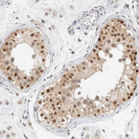 Immunohistochemistry-Paraffin ZNF683 Antibody - BSA Free
