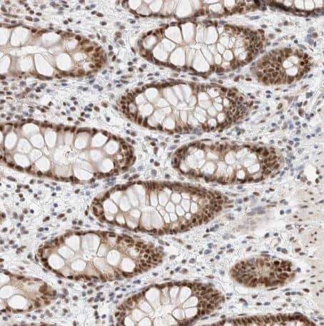 Immunohistochemistry-Paraffin ZNF683 Antibody - BSA Free