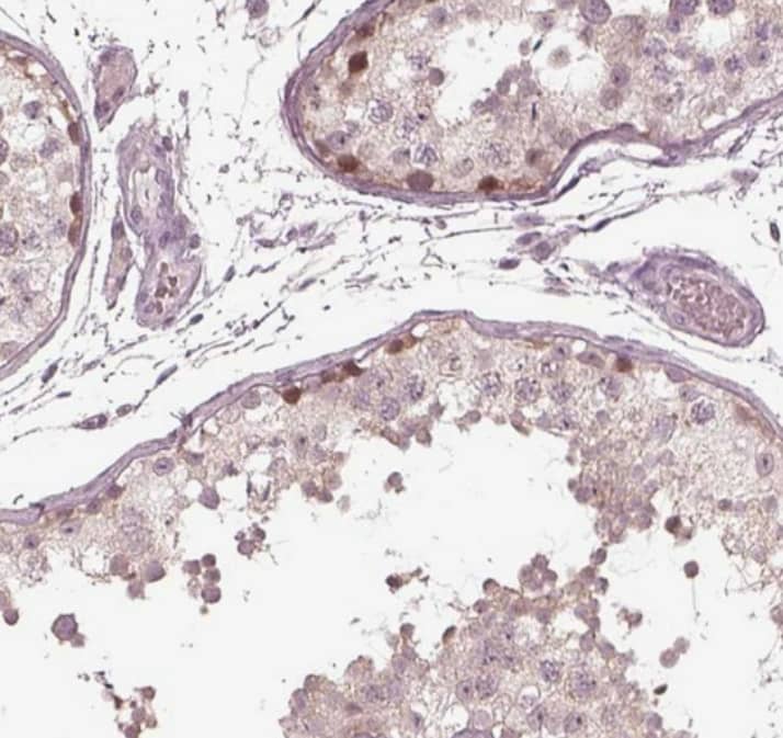 Staining of human testis shows moderate cytoplasmic positivity in spermatogonia.