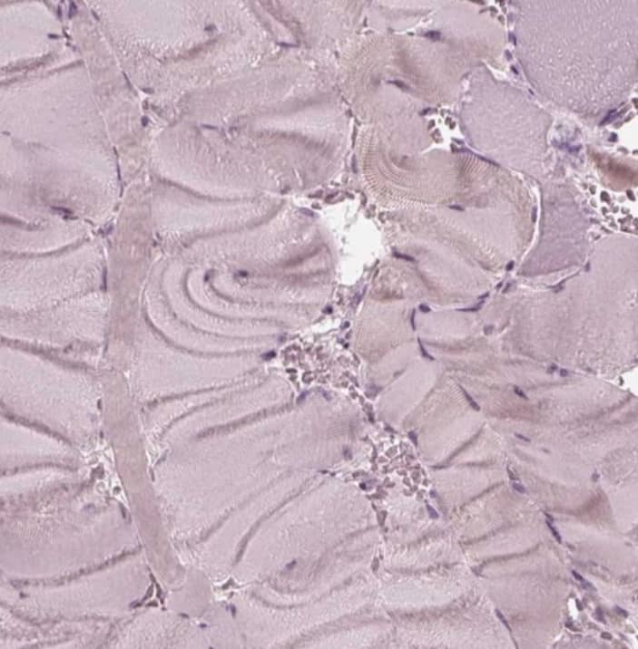 Staining of human skeletal muscle shows no positivity in myocytes as expected.