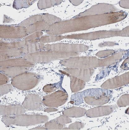 Immunohistochemistry-Paraffin: NEU3 Antibody [NBP2-48694] - Staining of human skeletal muscle shows moderate cytoplasmic positivity in myocytes.