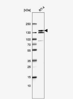 Western Blot: EVI-1 Antibody [NBP2-48848] -Analysis in human cell line RT-4.