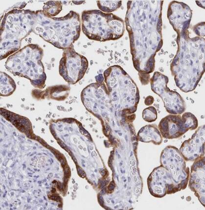 Immunohistochemistry-Paraffin: IL-27/IL-35 EBI3 Subunit Antibody [NBP2-48852] -Staining of human placenta shows strong cytoplasmic positivity in trophoblastic cells.
