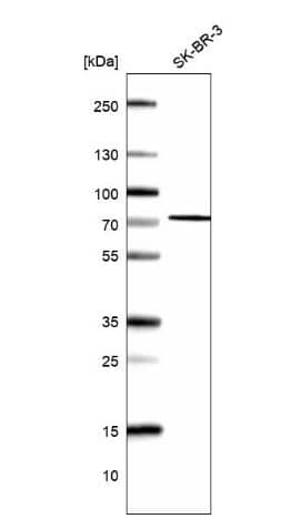 Western Blot: FLJ21963 Antibody [NBP2-48885] - Analysis in human cell line SK-BR-3.
