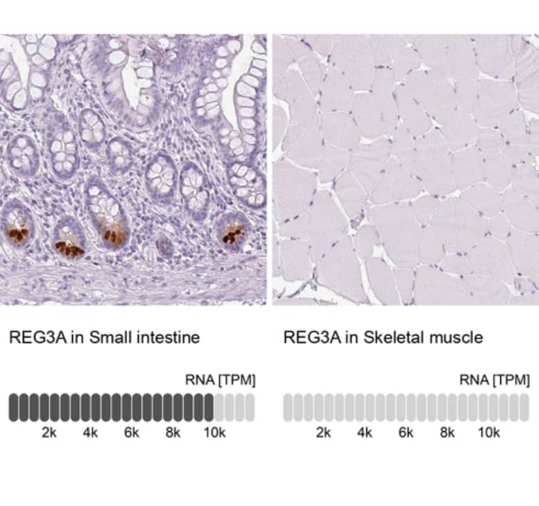 <b>Orthogonal Strategies Validation. </b> Analysis in human small intestine and skeletal muscle tissues using NBP2-48903 antibody. Corresponding REG3A RNA-seq data are presented for the same tissues.