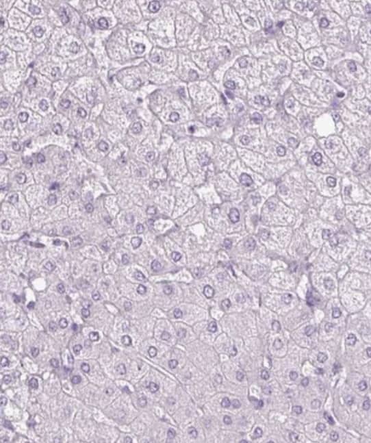 Staining of human liver shows no positivity in hepatocytes as expected.