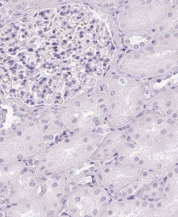 Staining of human kidney shows no positivity in cells in tubules as expected.