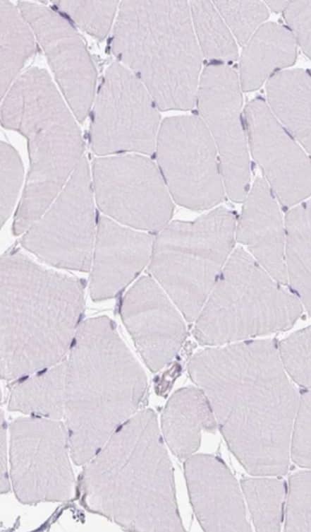 Staining of human skeletal muscle shows no positivity in myocytes as expected.