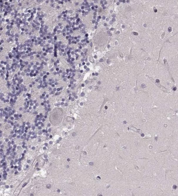 Staining of human cerebellum shows no positivity in Purkinje cells as expected.