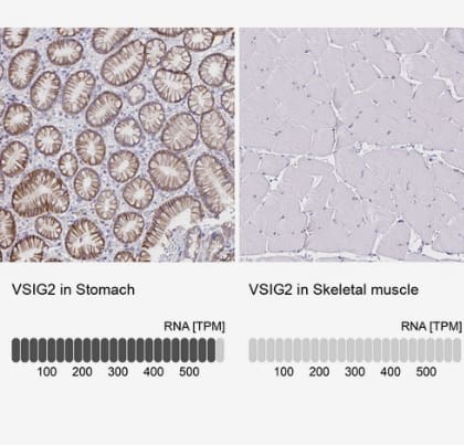 Immunohistochemistry-Paraffin: VSIG2 Antibody [NBP2-48955] -Analysis in human stomach and skeletal muscle tissues using NBP2-48955antibody. Corresponding VSIG2 RNA-seq data are presented for the same tissues.