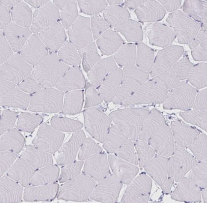 Immunohistochemistry-Paraffin: VSIG2 Antibody [NBP2-48955] - Staining of human skeletal muscle shows no positivity in myocytes as expected.