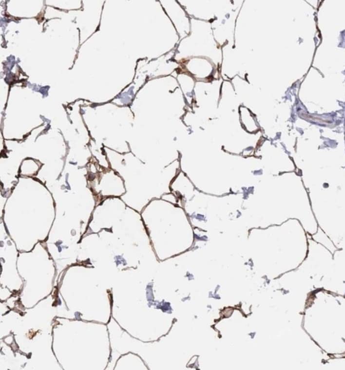 Staining of human soft tissue shows strong positivity in adipocytes.