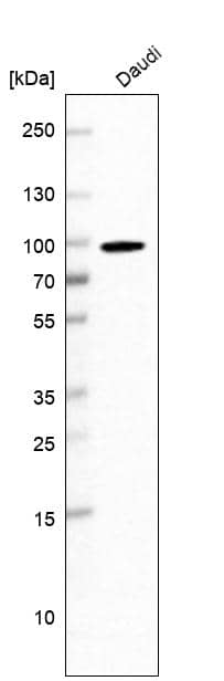 Analysis in human cell line Daudi.