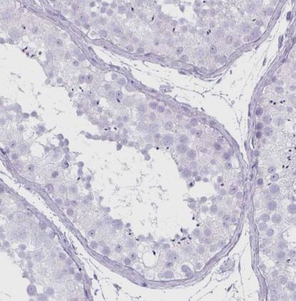 Immunohistochemistry-Paraffin: CLCA1 Antibody [NBP2-49060] - Staining of human testis shows no positivity in cells in seminiferous ducts as expected.