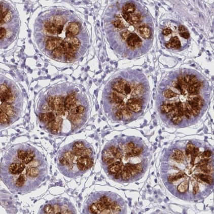 Immunohistochemistry-Paraffin: CLCA1 Antibody [NBP2-49060] -Staining of human colon shows strong cytoplasmic positivity in goblet cells.