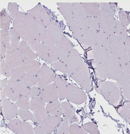 Immunohistochemistry-Paraffin: CLCA1 Antibody [NBP2-49060] -Staining of human skeletal muscle shows no positivity in myocytes as expected.
