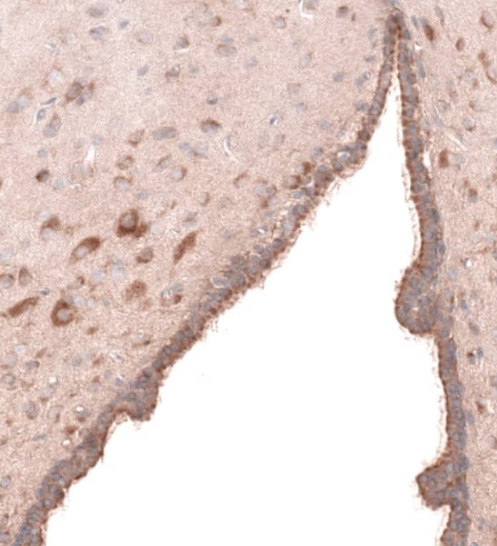 Staining of rat brain shows moderate cytoplasmic positivity in ependymal cells and neurons.