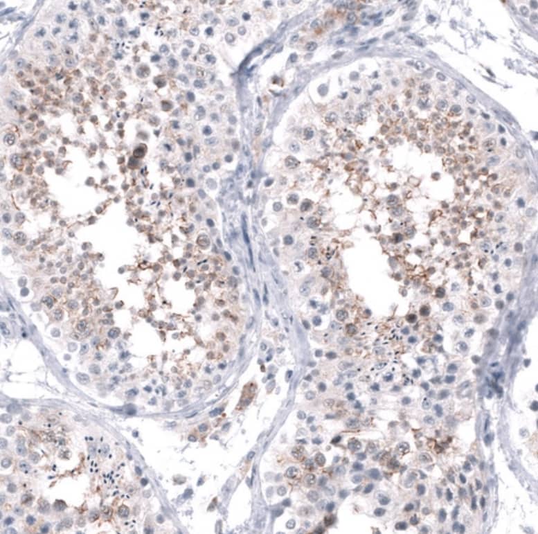 Staining of human testis shows moderate membranous positivity in cells in seminiferous ducts.
