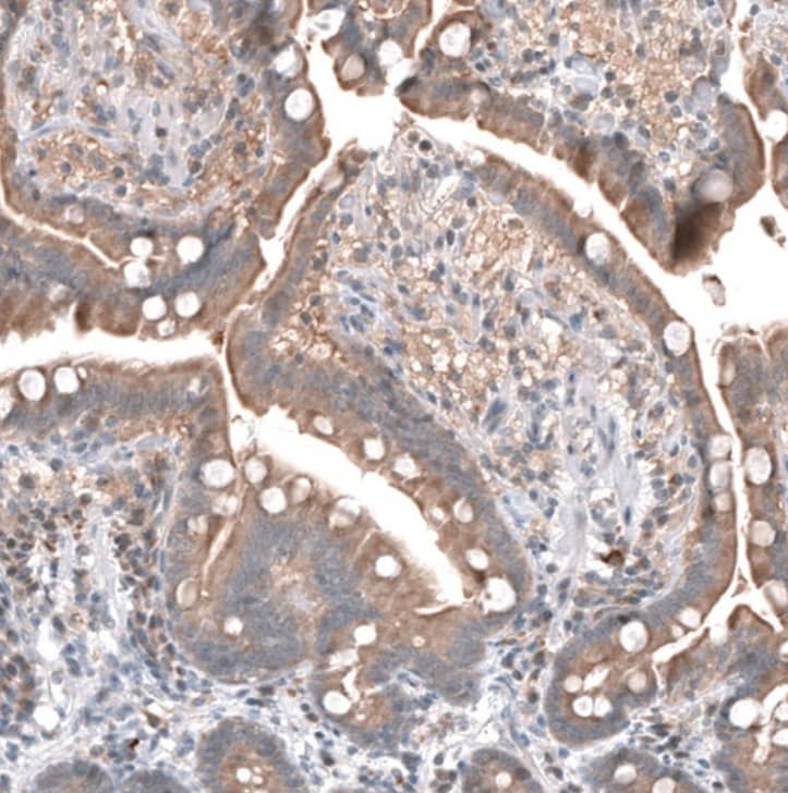 Staining of human small intestine shows moderate cytoplasmic positivity in glandular cells.