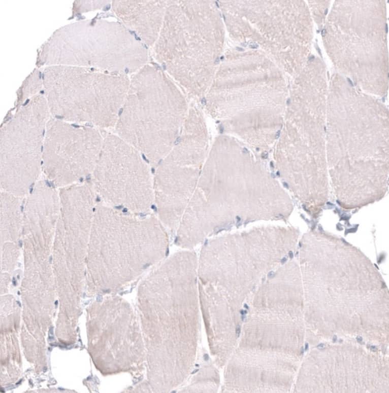 Staining of human skeletal muscle shows negative to very weak cytoplasmic positivity in myocytes.