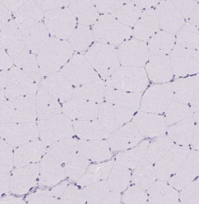 Staining of human skeletal muscle shows no cytoplasmic positivity in myocytes as expected.