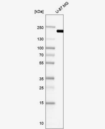 Western Blot: Clathrin Heavy Chain 1/CHC17 Antibody [NBP2-49293] -Analysis in human cell line U-87 MG.