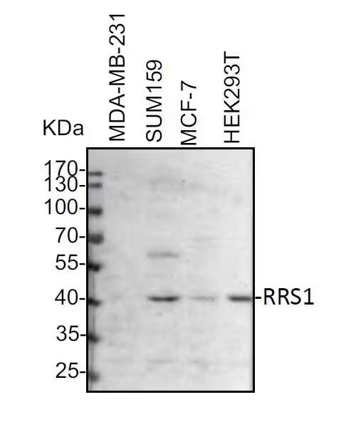 Western Blot: Rabbit Polyclonal RRS1 Antibody [NBP2-49323] - Whole cell lysates from MDA-MB-231, SUM159, MCF-7 and HEK293T cells were loaded with 50 ug/lane. 10% SDS-PAGE. RRS1 Antibody (NBP2-49323) was used for primary antibody: 1:1000, 4℃, overnight. Image from a verified customer review.
