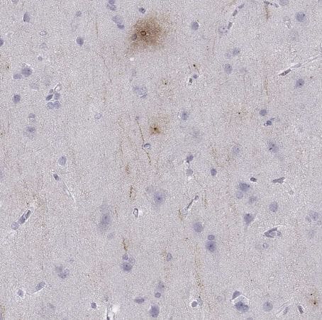 Immunohistochemistry-Paraffin: PCSK1N Antibody [NBP2-49423] -Staining of human cerebral cortex shows strong positivity in neuronal processes.