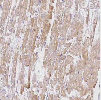 Immunohistochemistry-Paraffin: BATF Antibody [NBP2-49431] -Staining of human heart muscle shows moderate cytoplasmic positivity in cardiomyocytes.