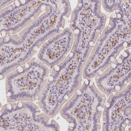 Immunohistochemistry-Paraffin: BATF Antibody [NBP2-49431] -Staining of human small intestine shows moderate cytoplasmic positivity in lymphoid cells.