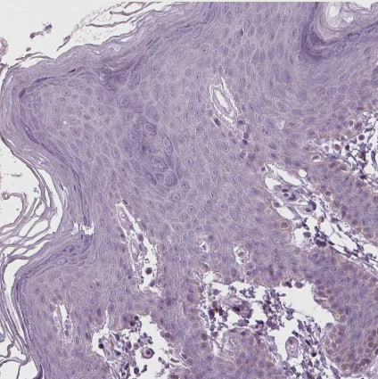 Immunohistochemistry-Paraffin: SAMD4A Antibody [NBP2-49440] -Staining of human skin shows no positivity in squamous epithelial cells.