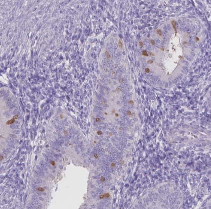 Immunohistochemistry-Paraffin: MMP-11 Antibody [NBP2-49575] -Staining of human endometrium shows moderate membranous positivity in a subset of glandular cells.