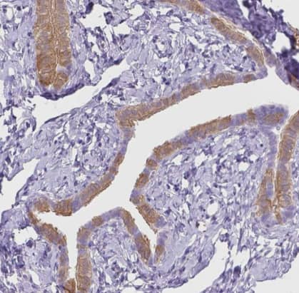 Immunohistochemistry-Paraffin: MMP-11 Antibody [NBP2-49575] -Staining of human fallopian tube shows moderate cytoplasmic positivity in glandular cells.