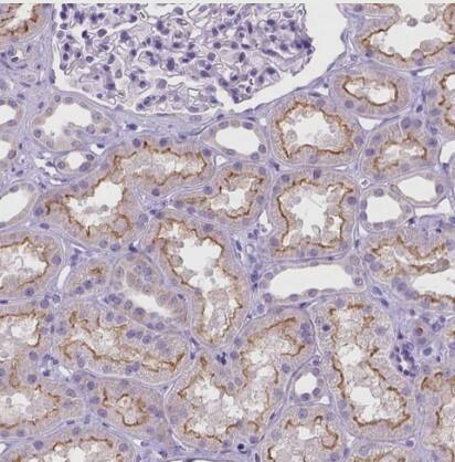 Immunohistochemistry-Paraffin: MMP-11 Antibody [NBP2-49575] - Staining of human kidney shows moderate membranous positivity in cells in tubules.