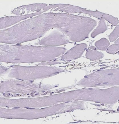 Immunohistochemistry-Paraffin: MMP-11 Antibody [NBP2-49575] - Staining of human skeletal muscle shows no positivity in myocytes as expected.