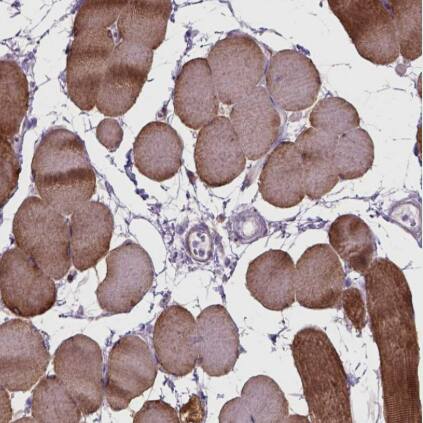 Immunohistochemistry-Paraffin: Tau Antibody [NBP2-49603] - Staining of human skeletal muscle shows moderate cytoplasmic positivity in myocytes.